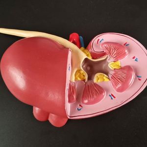 KyrenMed umano malato di anatomia del rene con calcoli urinari tumori malattia policistica a grandezza naturale modello di rene patologico - Product Image 5