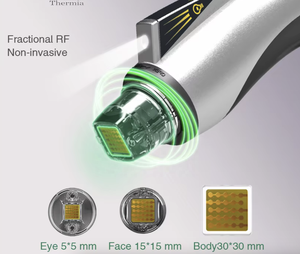 Vivace RF cartucho RF sistema - Product Image 5