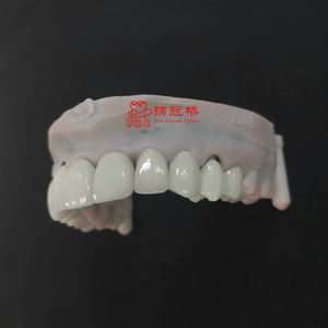 Laboratorio Dental <span class=keywords><strong>Precio</strong></span> Barato Restauraciones De Aspecto Natural Restauraciones De Porcelana IPS Emax Chapa - Product Image 4