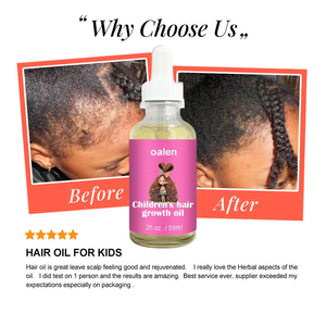 Huile de croissance capillaire personnalisée avec logo privé, <span class=keywords><strong>sérum</strong></span> essentiel à la rosemaine pour la croissance des cheveux des enfants - Product Image 6