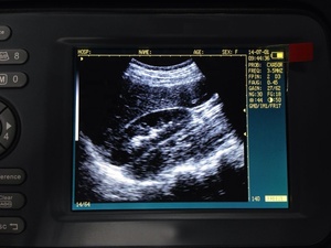 Ecógrafo Veterinario Portátil Completamente Digital, Instrumentos Médicos de Ultrasonido Prácticos, Ecógrafo Veterinario Portátil para Uso en Animales - Product Image 4