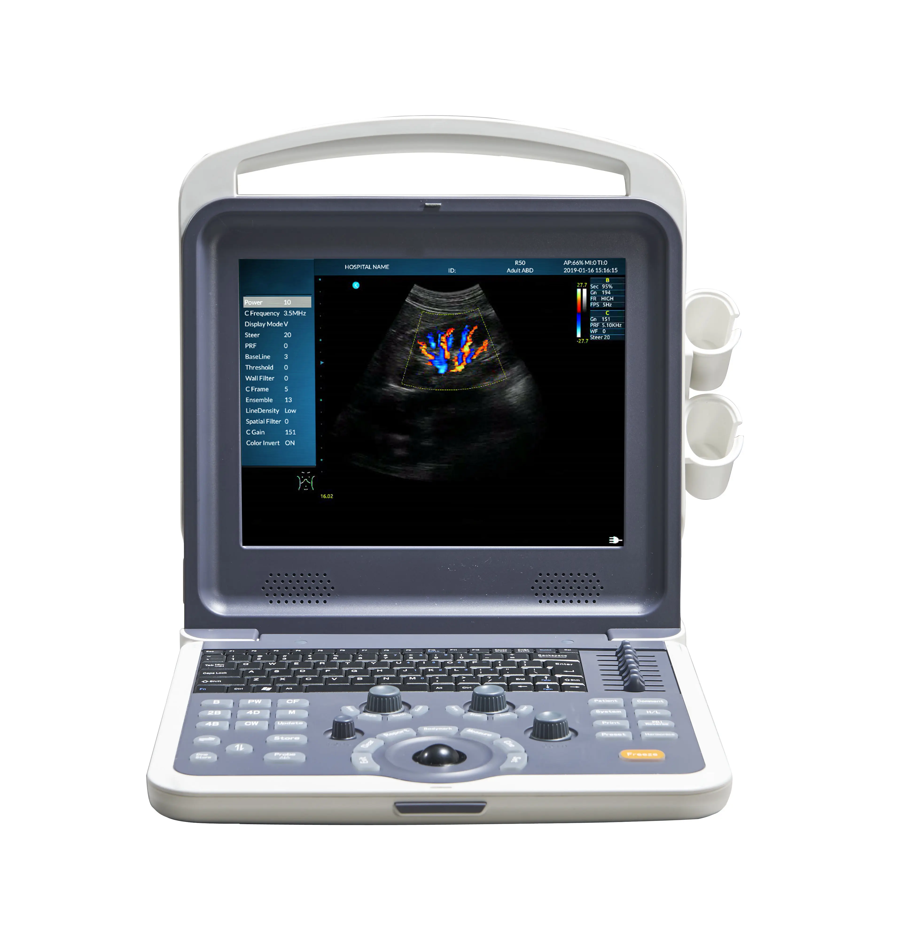 휴대용 전체 디지털 노트북 컬러 도플러 초음파 진단 시스템 초음파 스캐너 MSLCU62
