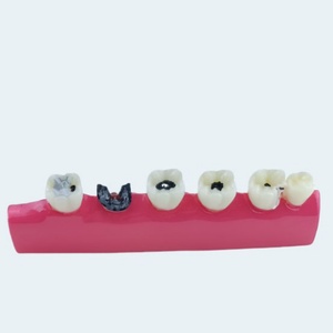 Modèle pédagogique d'hygiène bucco-dentaire : Manuel, caries dentaires, accessoires de soins dentaires, équipement de thérapie orale - Product Image 4