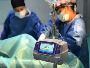 Bomba de Infusión de Jeringa Portátil, Precio de Bomba de Jeringa Eléctrica Médica Veterinaria para Hospital - Product Image 2