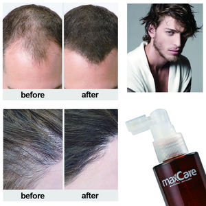 Tonico per Capelli Biologico Antiforfora e Stimolante della Crescita 120ml Fragranza Naturale - Product Image 5