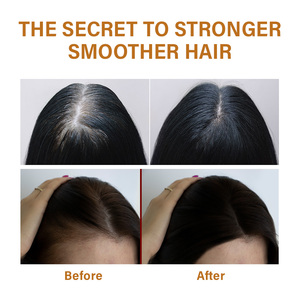 Marque privée Shampooing perte de <span class=keywords><strong>cheveux</strong></span> Shampooing OEM au gingembre <span class=keywords><strong>cheveux</strong></span> romarin anti-perte - Product Image 3