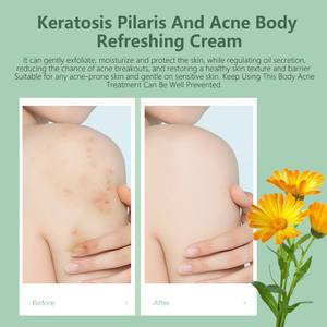 <span class=keywords><strong>ครีม</strong></span>รักษาสิวสำหรับทำความสะอาดร่างกายอย่างล้ำลึกขนาด48กรัม - Product Image 3