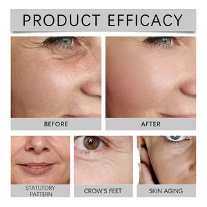 Vente de gros Sérum de soin de la <span class=keywords><strong>peau</strong></span> Sérum rétinoïde et squalane pour le visage Essence d'exfoliation anti-âge et anti-rides - Product Image 3