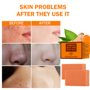 สบู่อาบน้ำขมิ้น Kojic Acid สบู่ล้างหน้าและทำความสะอาดผิวป้องกัน<span class=keywords><strong>สิว</strong></span>ก้อนสบู่ล้างหน้าให้ขาวกระจ่างใสสบู่ล้างมือ - Product Image 4