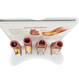कोरोनरी हृदय रोग के लिए शैक्षिक उपकरण 4-चरण स्टेंट तैनाती प्रदर्शन मॉडल - Product Image 2