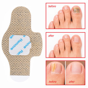 Meilleure Vente : <span class=keywords><strong>Traitement</strong></span> <span class=keywords><strong>des</strong></span> <span class=keywords><strong>Ongles</strong></span> Antifongique à l'Hydrogel (21 Patchs) – Soin Réparateur <span class=keywords><strong>des</strong></span> <span class=keywords><strong>Ongles</strong></span> <span class=keywords><strong>des</strong></span> Pieds, Renouvellement Nocturne, Patchs Antifongiques <span class=keywords><strong>pour</strong></span> <span class=keywords><strong>Ongles</strong></span> Abîmés - Product Image 2