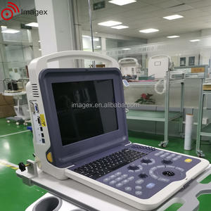 凸面と線形プローブを備えたポータブルカラードプラー超音波 - Product Image 6