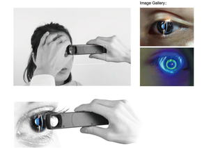 Lampe à fente portable InnoVue Opto PSL-150 avec garantie d'un an pour examen ophtalmique - Product Image 6