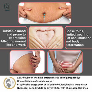 Vente en gros Marque privée Femme Crème réparatrice post-partum pour les vergetures Crème efficace après la naissance pour l'élimination des cicatrices et des vergetures - Product Image 4