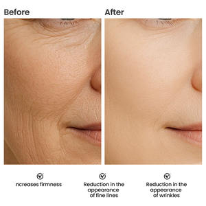 Loción de Ácido Ferúlico de 30 ml con Certificación <span class=keywords><strong>CE</strong></span>, Marca Privada, Blanqueadora, Antiarrugas, Reduce los Poros, con Vitamina C y E, para Uso Facial en Casa, con Muestra Gratuita - Product Image 4