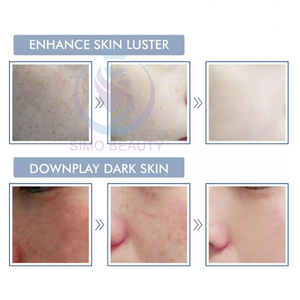 Cho thai giải pháp trẻ hóa độ đàn hồi phục hồi da mà cảm thấy sống collagen peptide Ampoule đã được phê duyệt - Product Image 6