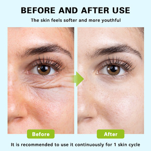 Sérum Visage Anti-Âge Hydratant et Anti-Rides au Cuivre Peptidique OEM GHK-Cu – <span class=keywords><strong>Soin</strong></span> de la <span class=keywords><strong>Peau</strong></span> au Cuivre Peptidique Bleu OEM - Product Image 5