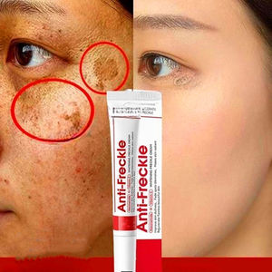 Crema Facial Iluminadora con Niacinamida 20g Ayuda a Mejorar el Tono de la Piel y Reducir la Apariencia de Manchas Oscuras y Pigmentación Desigual - Product Image 1