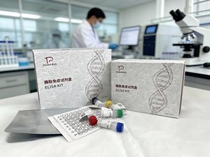 Kit ELISA para Análise Sandwich de Interleucina Humana 2 (IL-2) 48T/96T de Alta Qualidade com 99% de Pureza para Uso Exclusivo em Pesquisa - Product Image 2