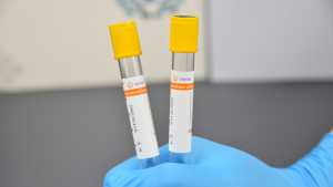 Xét nghiệm chẩn đoán phát hiện sơ tán bộ sưu tập máu ống kích hoạt cục máu đông với <span class=keywords><strong>gel</strong></span> phòng thí nghiệm y tế - Product Image 6