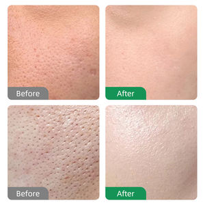 <span class=keywords><strong>โฟม</strong></span><span class=keywords><strong>ล้าง</strong></span><span class=keywords><strong>หน้า</strong></span>มาดากัสการ์เซนเทลล่า OEM ช่วยให้ผิวเรียบเ<span class=keywords><strong>น</strong></span>ีย<span class=keywords><strong>น</strong></span> <span class=keywords><strong>ลด</strong></span><span class=keywords><strong>สิว</strong></span> 80 กรัม IREV มาดากัสการ์เซนเทลล่า <span class=keywords><strong>โฟม</strong></span><span class=keywords><strong>ล้าง</strong></span><span class=keywords><strong>หน้า</strong></span><span class=keywords><strong>ลด</strong></span><span class=keywords><strong>สิว</strong></span> - Product Image 2