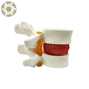 Sains medis Lumbar Disc Herniation Simulator tulang belakang Vertebral Model - Product Image 6