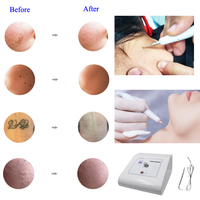 AU-202 Auro Beauty Appareil d'électrocautérisation cutanée pour l'élimination des verrues, des grains de beauté et des taches, usage professionnel en salon