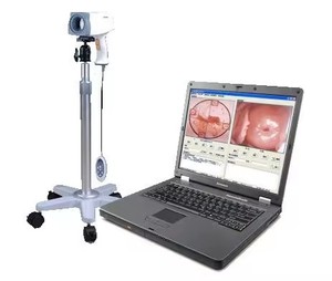 Sistem pencitraan colposkop <span class=keywords><strong>Video</strong></span> ginekologi Digital elektronik portabel Colposcope Pemeriksaan Vagina untuk ginekologi - Product Image 3