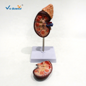 Modelo Anatómico de Riñón Humano para Ciencias Médicas, 2 Partes, Modelo Anatómico de la Estructura del Riñón Humano - Product Image 1