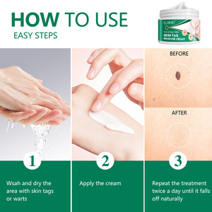 ELAIMEI Custom OEM ODM Skin Tag &amp; <strong>Wart</strong> <strong>Remover</strong> <strong>Cream</strong> 100% Natural Herbal Manufacturer Private Label Support Fast Shipping - Product Image 5