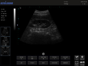 Promotion <span class=keywords><strong>Sonoscape</strong></span> <span class=keywords><strong>S11</strong></span> Plus Système d'échocardiographie 3D 4D Chariot Échographe Doppler couleur pour hôpital - Product Image 6