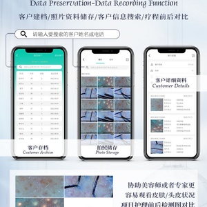 Analyseur portable de peau, cuir chevelu et follicules pileux, nouvelle machine d'analyse de la peau et des cheveux, détecteur HD de cuir chevelu et de cheveux - Product Image 4