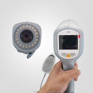 Caméra d'<span class=keywords><strong>endoscopie</strong></span> de colposcope de gynécologie de KN-2200A numérique pour l'examen visuel de colposcope - Product Image 4