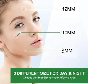 Est Elling EW Kin son roducts CCNE pot rereatment 36PCs nvisible yydrocoloid imimple Patches - Product Image 5