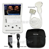 Appareil d'échographie médical portable pour humains, grand écran de 15 pouces, approuvé CE ISO, Mindray DP-20 DP-50