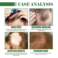 Minyak Esensial Perawatan Rambut Batana Organik Alami  Mempromosikan Pertumbuhan Rambut & Mencegah Kerontokan Rambut  Minyak Nabati Murni & Lembut