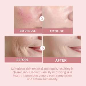 Ampolla de Salmón CHUSN PDRN para la Regeneración <span class=keywords><strong>Celular</strong></span>, Renovación y Reparación de la Piel, Suero Reparador de Grado Profesional para Clínicas Dermatológicas - Product Image 3