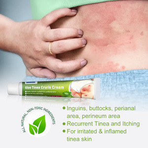Crema de Aloe para Tinea Cruris, Cuidado Corporal, Hierba Antipruriginosa, Tratamiento para Hongos - Product Image 3