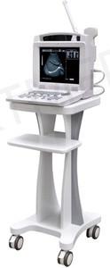 KT-A012 Portable Digital VET/human B/W Ultrasound Laptop Type Black and White Ultrasound Scanner Machine for <strong>Pregnancy</strong> - Product Image 5