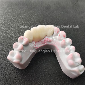 Clinique dentaire meilleur choix solution de <span class=keywords><strong>dents</strong></span> manquantes fraisage CNC couronnes et pont en zircone avec gomme en céramique - Product Image 6