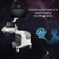 Ecógrafo Doppler Color 3D 4D SonoScape P80 ELITE de Alta Calidad con Software Profesional de IA para Hospitales y Clínicas