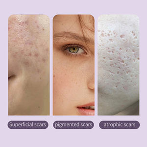 Private Label Natural Reduzieren Sie Falten Anti Aging Moist urizing White ning Hyaluron säure Serum Schnecken schleim Extrakt Gesichts serum - Product Image 2