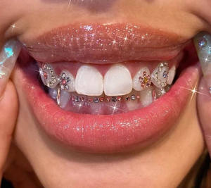 Gioiello Dentale con Cristallo Brillante per la Decorazione dei Denti, Diamante per Denti - Product Image 3