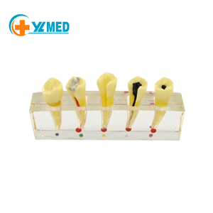 Bác sĩ nha khoa bệnh nhân truyền thông mô hình bệnh lý mô hình sửa chữa bệnh tủy với cấu trúc răng xấu có thể tháo rời - Product Image 2