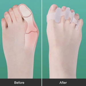 Corrector de silicona para el cuidado de los <span class=keywords><strong>pies</strong></span>, herramientas ortopédicas para el cuidado de los <span class=keywords><strong>pies</strong></span>, Reduce la fricción y el <span class=keywords><strong>dolor</strong></span>, separador de <span class=keywords><strong>dedos</strong></span>, tacones altos - Product Image 4