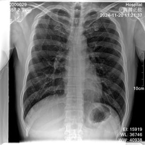 Appareil de radiographie vétérinaire portable, machine à rayons <span class=keywords><strong>X</strong></span> portative, système DR avec détecteur à panneau plat, appareil médical électrique, durable, prix Xr - Product Image 2