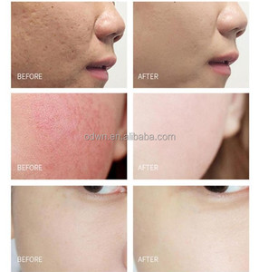 Personnaliser visage blanchiment de cuivre peptide poudre lyophilisée OTVENA - Product Image 3