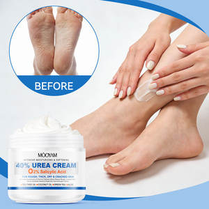 Crema Exfoliante Corporal con 2% de Ácido Salicílico y 40% de Urea, Crema Hidratante para Piel Seca, Crema Calmante con Extractos de Plantas, Marca Privada OEM - Product Image 1