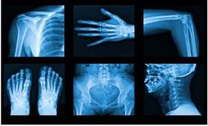 Équipement de radiologie médicale haute fréquence portable xray vétérinaire portable xray vétérinaire portable xray pour chiens - Product Image 5