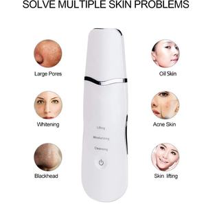 Exfoliador Facial USB Recargable, Herramienta de Exfoliación Ultrasónica para la Piel del Rostro, Máquina para el Cuidado de la Belleza - Product Image 2